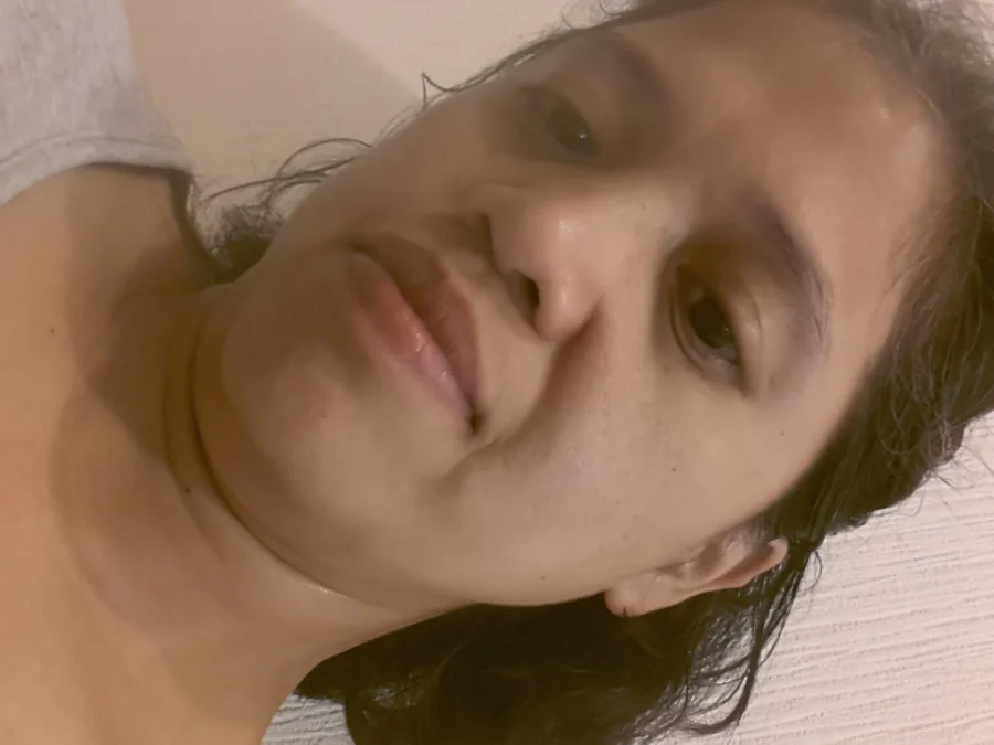 Edna Migue, 49