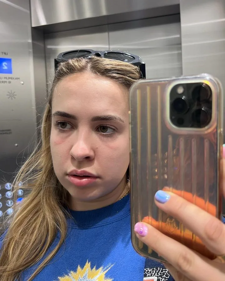 Alex mary, 32